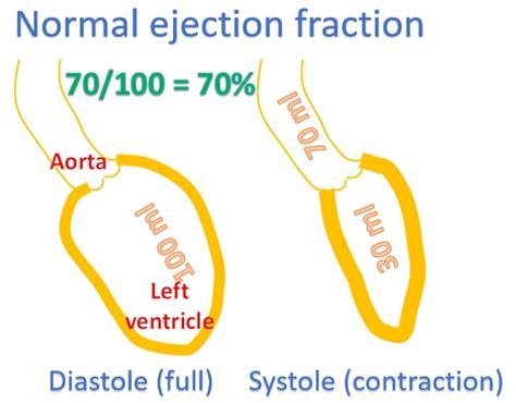 what is considered preserved ef.